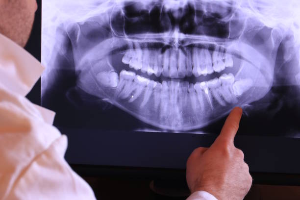 Best Holiday Emergency Dentist in Lake Worth, TX